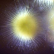 Gleotrichia_8-17-16-DSC_2596_compressed