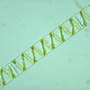 spirogyra