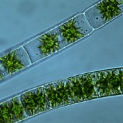 zygnema
