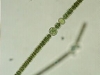 anabena2